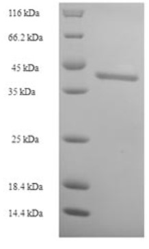 SDS-PAGE (DNM1-458H).jpg